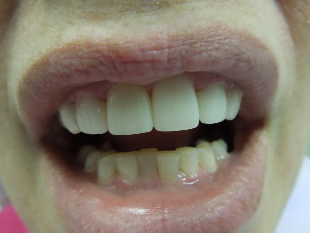 The same patient's teeth after treatment at Dynamic Dental Arts, case 16
